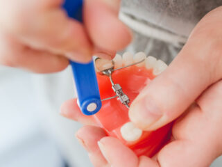 Cooper Orthodontics in Houston & Lake Jackson, TX