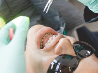 Braces for Teens - Cooper Orthodontics in Houston & Lake Jackson, TX