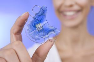 5 Tips for Keeping Track of Your Retainer