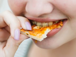 Summer Snacking with Braces: Healthy Choices for Patients with Braces